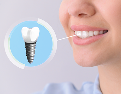 The image shows a close-up of a person s face with a smile, and there is an illustration of a screw or drill on the lower right side of the mouth.