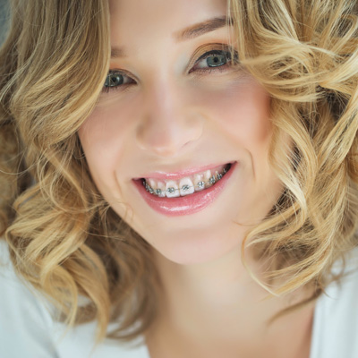 The image is a portrait of a woman with straight, white teeth and a radiant smile. She has light brown hair styled in loose waves and is wearing makeup that includes eye shadow and lipstick.
