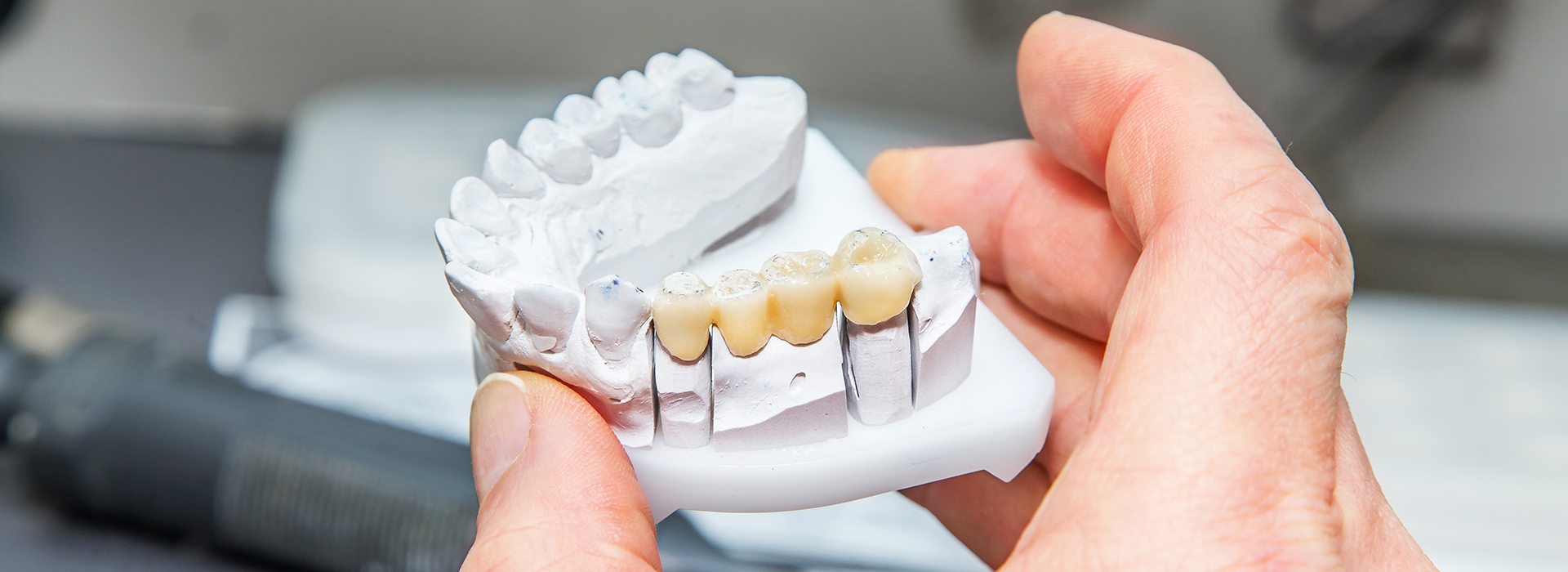 An individual s hand holding a 3D printed dental model with visible teeth.