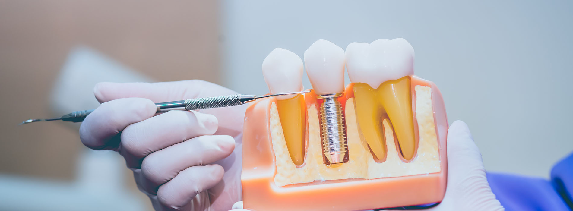 The image shows a person using a dental tool to adjust or remove an artificial tooth from a plastic model of a mouth.