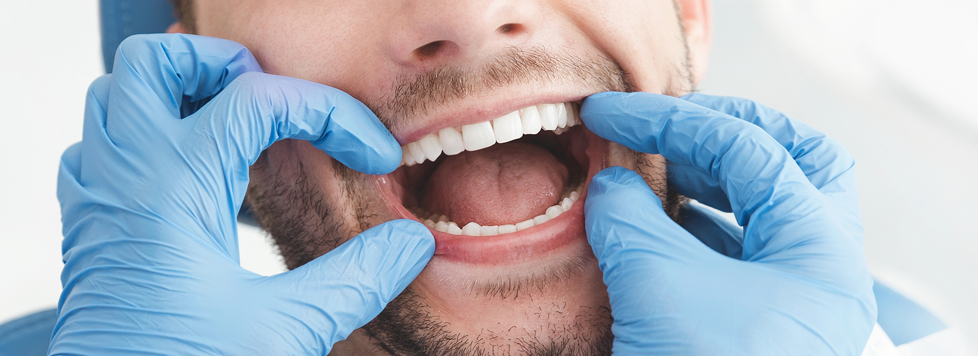 A man wearing a white lab coat and blue gloves is holding his mouth open with both hands, appearing to be in a dental office or exam room.