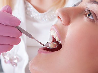 A dental professional performing a procedure on an open mouth, with focus on the process.